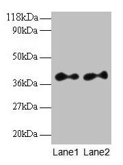 Western blot  | All lanes: SCAMP3 antibody at 2µg/ml  | Lane 1: EC109 whole cell lysate  | Lane 2: 293T whole cell lysate  | Secondary  | Goat polyclonal to rabbit IgG at 1/15000 dilution  | Predicted band size: 39, 36 kDa  | Observed band size: 39 kDaRabbit anti-Human SCAMP3 Polyclonal Antibody