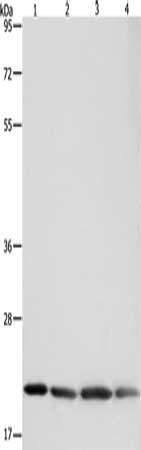 Gel: 8+12%SDS-PAGE, Lysate: 40 μg, Lane 1-4: Human brain malignant glioma tissue, MCF7 cells, Raji cells, Lovo cells, Primary antibody: BAX Antibody(BAX Antibody) at dilution 1/300, Secondary antibody: Goat anti rabbit IgG at 1/8000 dilution, Exposure time: 7 seconds