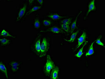 Immunofluorescent analysis of Hela cells using CDK11A Antibody at dilution of 1:100 and Alexa Fluor 488-congugated AffiniPure Goat Anti-Rabbit IgG(H+L)Rabbit anti-Human CDK11A Polyclonal Antibody
