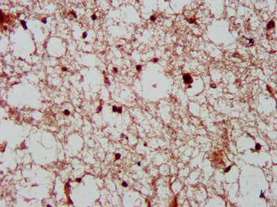 IHC image of CDK11A Antibody diluted at 1:600 and staining in paraffin-embedded human brain tissue performed on a Leica BondTM system. After dewaxing and hydration, antigen retrieval was mediated by high pressure in a citrate buffer (pH 6.0). Section was blocked with 10% normal goat serum 30min at RT. Then primary antibody (1% BSA) was incubated at 4°C overnight. The primary is detected by a biotinylated secondary antibody and visualized using an HRP conjugated SP system.Rabbit anti-Human CDK11A Polyclonal Antibody