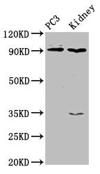 Western Blot  | Positive WB detected in: PC-3 whole cell lysate, Rat kidney tissue  | All lanes: CDK11A antibody at 4µg/ml  | Secondary  | Goat polyclonal to rabbit IgG at 1/50000 dilution  | Predicted band size: 92, 91, 46, 19, 63, 50 kDa  | Observed band size: 92 kDaRabbit anti-Human CDK11A Polyclonal Antibody