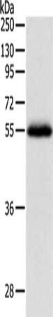 Gel: 10%SDS-PAGE, Lysate: 60 μg, Lane: Human leiomyosarcoma tissue, Primary antibody: NPY1R Antibody(NPY1R Antibody) at dilution 1/400, Secondary antibody: Goat anti rabbit IgG at 1/8000 dilution, Exposure time: 2 minutesRabbit anti-Human NPY1R Polyclonal Antibody