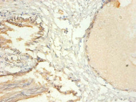 Immunohistochemistry of paraffin-embedded human prostate tissue using TRIM28 Antibody at dilution of 1:100Rabbit anti-Human TRIM28 Polyclonal Antibody
