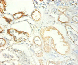 Immunohistochemistry of paraffin-embedded human kidney tissue using TRIM28 Antibody at dilution of 1:100Rabbit anti-Human TRIM28 Polyclonal Antibody