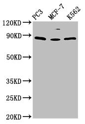 Western Blot | Positive WB detected in: PC-3 whole cell lysate, MCF-7 whole cell lysate, K562 whole cell lysate | All lanes: TRIM28 antibody at 1.5μg/ml | Secondary | Goat polyclonal to rabbit IgG at 1/50000 dilution | Predicted band size: 89, 80 kDa | Observed band size: 89 kDaRabbit anti-Human TRIM28 Polyclonal Antibody