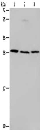 Gel: 10%SDS-PAGE, Lysate: 40 μg, Lane 1-3: Human fetal liver tissue, 293T cells, 231 cells, Primary antibody: TP53INP1 Antibody(TP53INP1 Antibody) at dilution 1/200, Secondary antibody: Goat anti rabbit IgG at 1/8000 dilution, Exposure time: 1 minuteRabbit anti-Human TP53INP1 Polyclonal Antibody