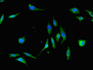 Immunofluorescent analysis of Hela cells using XBP1 Antibody at dilution of 1:100 and Alexa Fluor 488-congugated AffiniPure Goat Anti-Rabbit IgG(H+L)Rabbit anti-Human XBP1 Polyclonal Antibody