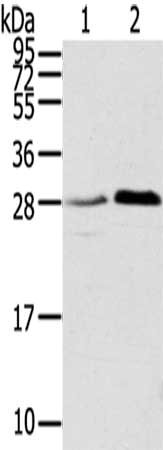 Gel: 12%SDS-PAGE,Lysate: 40 μg,Lane 1-2: 231 cells, A172 cells,Primary antibody: TMED1 Antibody(TMED1 Antibody) at dilution 1/400 dilution,Secondary antibody: Goat anti rabbit IgG at 1/8000 dilution,Exposure time: 40 secondsRabbit anti-Human TMED1 Polyclonal Antibody