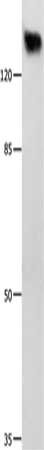 Gel: 8%SDS-PAGE, Lysate: 60 μg, Lane: Hela cells, Primary antibody: GRM1 Antibody(GRM1 Antibody) at dilution 1/125, Secondary antibody: Goat anti rabbit IgG at 1/8000 dilution, Exposure time: 1 minuteRabbit anti-Human GRM1 Polyclonal Antibody