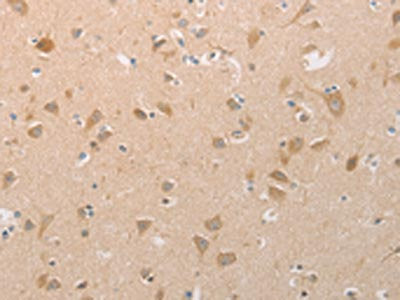 The image on the left is immunohistochemistry of paraffin-embedded Human brain tissue using PGA3/PGA4/PGA5 Antibody(PGA3/PGA4/PGA5 Antibody) at dilution 1/40, on the right is treated with synthetic peptide. (Original magnification: ×200)Rabbit anti-Human PGA3/PGA4/PGA5 Polyclonal Antibody