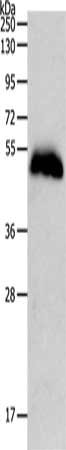 Gel: 10%SDS-PAGE, Lysate: 60 μg, Lane: Human liver cancer tissue, Primary antibody: PGA3/PGA4/PGA5 Antibody(PGA3/PGA4/PGA5 Antibody) at dilution 1/700, Secondary antibody: Goat anti rabbit IgG at 1/8000 dilution, Exposure time: 1 minuteRabbit anti-Human PGA3/PGA4/PGA5 Polyclonal Antibody