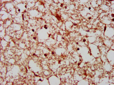 IHC image of PAK4 Antibody diluted at 1:800 and staining in paraffin-embedded human brain tissue performed on a Leica BondTM system. After dewaxing and hydration, antigen retrieval was mediated by high pressure in a citrate buffer (pH 6.0). Section was blocked with 10% normal goat serum 30min at RT. Then primary antibody (1% BSA) was incubated at 4°C overnight. The primary is detected by a biotinylated secondary antibody and visualized using an HRP conjugated SP system.Rabbit anti-Human PAK4 Polyclonal Antibody