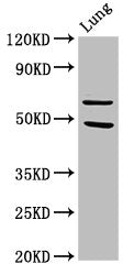Western Blot  | Positive WB detected in: Rat lung tissue  | All lanes: PAK4 antibody at 3.2µg/ml  | Secondary  | Goat polyclonal to rabbit IgG at 1/50000 dilution  | Predicted band size: 65, 48, 49, 55 kDa  | Observed band size: 65 kDaRabbit anti-Human PAK4 Polyclonal Antibody
