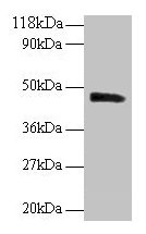 Western blot  | All lanes: PICK1 antibody at 2µg/ml + Mouse brain tissue  | Secondary  | Goat polyclonal to rabbit IgG at 1/10000 dilution  | Predicted band size: 47, 40 kDa  | Observed band size: 47 kDaRabbit anti-Human PICK1 Polyclonal Antibody