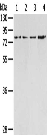 Gel: 8%SDS-PAGE, Lysate: 40 μg, Lane 1-4: A431 cells, Raji cells, hepg2 cells, hela cells, Primary antibody: TAF15 Antibody(TAF15 Antibody) at dilution 1/350, Secondary antibody: Goat anti rabbit IgG at 1/8000 dilution, Exposure time: 10 secondsRabbit anti-Human TAF15 Polyclonal Antibody
