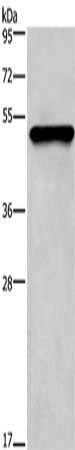 Gel: 8%SDS-PAGE, Lysate: 20 μg, Lane: Mouse skin tissue, Primary antibody: KRT14 Antibody(KRT14 Antibody) at dilution 1/1350, Secondary antibody: Goat anti rabbit IgG at 1/8000 dilution, Exposure time: 20 secondsRabbit anti-Human KRT14 Polyclonal Antibody