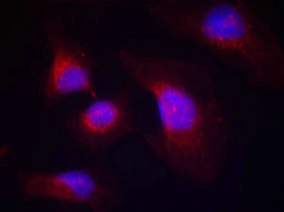 Immunofluorescence staining of methanol-fixed Hela cells using syk(phospho-Tyr323) Antibody.Rabbit anti-Human SYK Polyclonal Antibody