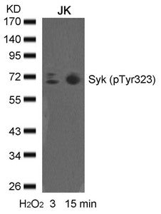 Western blot analysis of extracts from JK cells untreated or treated with H2O2 for the indicated times, using syk(phospho-Tyr323) Antibody.Rabbit anti-Human SYK Polyclonal Antibody
