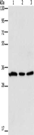 Gel: 15%SDS-PAGE, Lysate: 40 μg, Lane 1-3: 293T cells, human colon cancer tissue, 231 cells, Primary antibody: GPA33 Antibody(GPA33 Antibody) at dilution 1/600, Secondary antibody: Goat anti rabbit IgG at 1/8000 dilution, Exposure time: 5 secondsRabbit anti-Human GPA33 Polyclonal Antibody