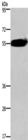 Gel: 6%SDS-PAGE,Lysate: 40 μg,,Primary antibody: ACVR2A Antibody(ACVR2A Antibody) at dilution 1/400 dilution,Secondary antibody: Goat anti rabbit IgG at 1/8000 dilution,Exposure time: 2 minutesRabbit anti-Human ACVR2A Polyclonal Antibody