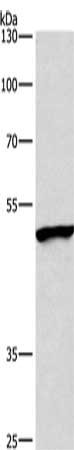 Gel: 8%SDS-PAGE, Lysate: 40 μg, Lane: A549 cells, Primary antibody: BMP15 Antibody(BMP15 Antibody) at dilution 1/400, Secondary antibody: Goat anti rabbit IgG at 1/8000 dilution, Exposure time: 40 seconds