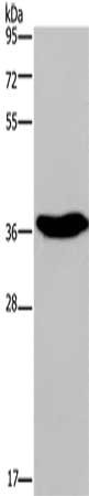 Gel: 10%SDS-PAGE, Lysate: 40 μg, Lane: Human fetal brain tissue, Primary antibody: ELAVL3 Antibody(ELAVL3 Antibody) at dilution 1/350, Secondary antibody: Goat anti rabbit IgG at 1/8000 dilution, Exposure time: 3 minutesRabbit anti-Human ELAVL3 Polyclonal Antibody