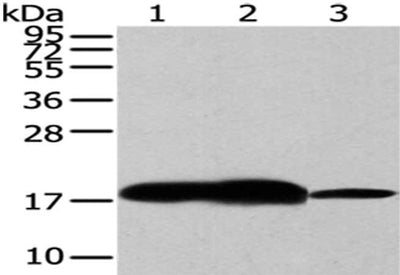 Gel: 12%SDS-PAGE,Lysate: 40 μg,Lane 1-3: Human fetal brain tissue, Mouse brain tissue, Hela cells,Primary antibody: VAMP2 Antibody(VAMP2 Antibody) at dilution 1/200 dilution,Secondary antibody: Goat anti rabbit IgG at 1/8000 dilution,Exposure time: 30 secondsRabbit anti-Human VAMP2 Polyclonal Antibody