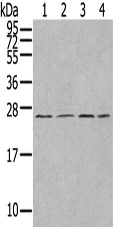 Gel: 12%SDS-PAGE,Lysate: 40 μg,Lane 1-4: A549 cells, Jurkat cells, A375 cells, HepG2 cells,Primary antibody: UBTD1 Antibody(UBTD1 Antibody) at dilution 1/300 dilution,Secondary antibody: Goat anti rabbit IgG at 1/8000 dilution,Exposure time: 1 minuteRabbit anti-Human UBTD1 Polyclonal Antibody