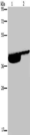 Gel: 8%SDS-PAGE, Lysate: 40 μg, Lane 1-2: Human bladder tissue, Human bladder transitional cell carcinoma tissue, Primary antibody: P2RX3 Antibody(P2RX3 Antibody) at dilution 1/250, Secondary antibody: Goat anti rabbit IgG at 1/8000 dilution, Exposure time: 10 minutesRabbit anti-Human P2RX3 Polyclonal Antibody