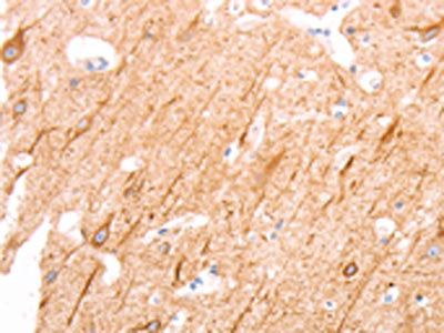 The image on the left is immunohistochemistry of paraffin-embedded Human brain tissue using the antibody Antibody) at dilution 1/25, on the right is treated with synthetic peptide. (Original magnification: ×200)Rabbit anti-Human INA Polyclonal Antibody