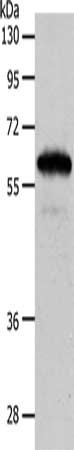 Gel: 10%SDS-PAGE, Lysate: 40 μg, Lane: Mouse brain tissue, Primary antibody: INA Antibody(INA Antibody) at dilution 1/550, Secondary antibody: Goat anti rabbit IgG at 1/8000 dilution, Exposure time: 3 secondsRabbit anti-Human INA Polyclonal Antibody