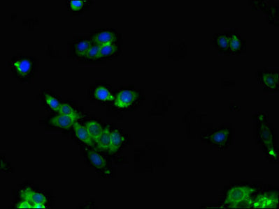 Immunofluorescent analysis of HepG2 cells using ALDOC Antibody at dilution of 1:100 and Alexa Fluor 488-congugated AffiniPure Goat Anti-Rabbit IgG(H+L)Rabbit anti-Human ALDOC Polyclonal Antibody