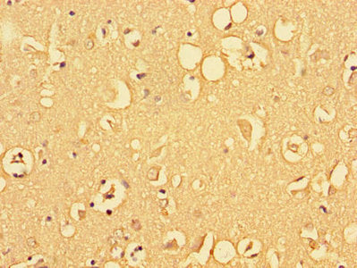 Immunohistochemistry of paraffin-embedded human brain tissue using ALDOC Antibody at dilution of 1:100Rabbit anti-Human ALDOC Polyclonal Antibody