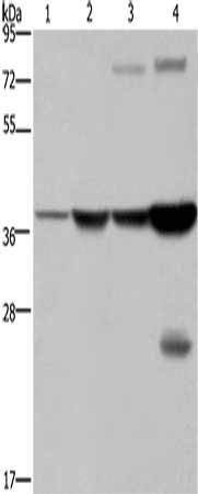 Gel: 8%SDS-PAGE, Lysate: 40 μg, Lane 1-4: Mouse stomach tissue, human fetal liver tissue, MCF7 cells, mouse liver tissue tissue, Primary antibody: FBP1 Antibody(FBP1 Antibody) at dilution 1/550, Secondary antibody: Goat anti rabbit IgG at 1/8000 dilution, Exposure time: 10 secondsRabbit anti-Human FBP1 Polyclonal Antibody