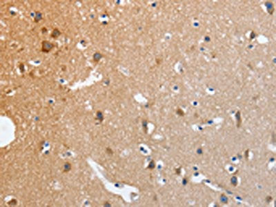 The image on the left is immunohistochemistry of paraffin-embedded Human brain  tissue using NCK1 Antibody(NCK1 Antibody) at dilution 1/20, on the right is treated with fusion protein. (Original magnification: x200)Rabbit anti-Human NCK1 Polyclonal Antibody