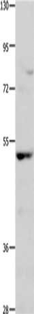 Gel: 10%SDS-PAGE, Lysate: 40μg, Lane: Hela cells, Primary antibody: NCK1 Antibody(NCK1 Antibody) at dilution 1/350, Secondary antibody: Goat anti rabbit IgG at 1/8000 dilution, Exposure time: 1 minuteRabbit anti-Human NCK1 Polyclonal Antibody