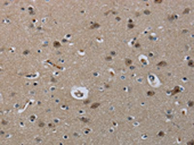 The image on the left is immunohistochemistry of paraffin-embedded Human brain  tissue using MRE11A Antibody(MRE11A Antibody) at dilution 1/60, on the right is treated with fusion protein. (Original magnification: ×200)