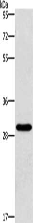 Gel: 10%SDS-PAGE, Lysate: 40 μg, Lane: Hela cells, Primary antibody: BCL10 Antibody(BCL10 Antibody) at dilution 1/950, Secondary antibody: Goat anti rabbit IgG at 1/8000 dilution, Exposure time: 40 seconds