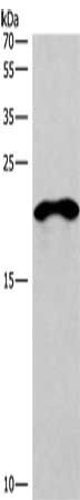 Gel: 10%SDS-PAGE, Lysate: 40 μg, Lane: Mouse skeletal muscle tissue, Primary antibody: TNFRSF17 Antibody(TNFRSF17 Antibody) at dilution 1/200, Secondary antibody: Goat anti rabbit IgG at 1/8000 dilution, Exposure time: 15 secondsRabbit anti-Human TNFRSF17 Polyclonal Antibody