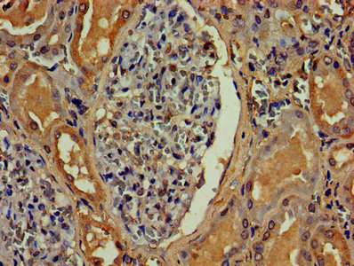 IHC image of ANGPT2 Antibody diluted at 1:800 and staining in paraffin-embedded human kidney tissue performed on a Leica BondTM system. After dewaxing and hydration, antigen retrieval was mediated by high pressure in a citrate buffer (pH 6.0). Section was blocked with 10% normal goat serum 30min at RT. Then primary antibody (1% BSA) was incubated at 4°C overnight. The primary is detected by a biotinylated secondary antibody and visualized using an HRP conjugated SP system.Rabbit anti-Human ANGPT2 Polyclonal Antibody