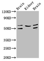 Western Blot  | Positive WB detected in: Rat brain tissue, Rat kidney tissue, Mouse brain tissue  | All lanes: ANGPT2 antibody at 3.2µg/ml  | Secondary  | Goat polyclonal to rabbit IgG at 1/50000 dilution  | Predicted band size: 57, 51 kDa  | Observed band size: 57, 51 kDaRabbit anti-Human ANGPT2 Polyclonal Antibody