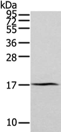 Gel: 12%SDS-PAGE, Lysate: 40 μg, Lane: Human normal kidney tissue, Primary antibody: ZFAND2A Antibody(ZFAND2A Antibody) at dilution 1/300 dilution, Secondary antibody: Goat anti rabbit IgG at 1/8000 dilution, Exposure time: 2 minutesRabbit anti-Human ZFAND2A Polyclonal Antibody