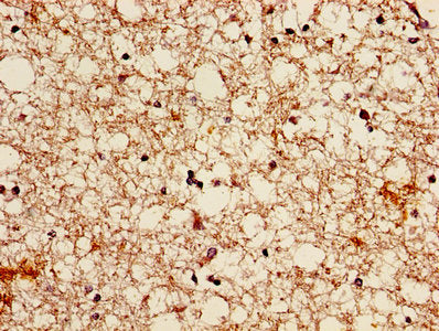 Immunohistochemistry of paraffin-embedded human brain tissue using BMP7 Antibody at dilution of 1:100
