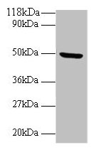 Western blot  | All lanes: BMP7 antibody at 2µg/ml + Mouse kidney tissue  | Secondary  | Goat polyclonal to rabbit IgG at 1/10000 dilution  | Predicted band size: 50 kDa  | Observed band size: 50 kDa