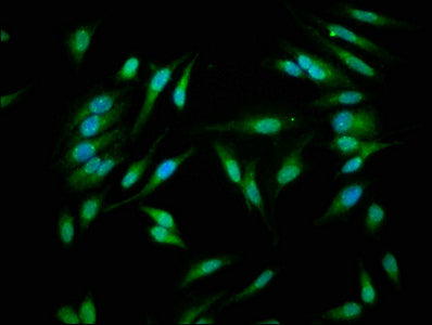 Immunofluorescence staining of Hela cells with CASP1 Antibody at 1:266, counter-stained with DAPI. The cells were fixed in 4% formaldehyde, permeabilized using 0.2% Triton X-100 and blocked in 10% normal Goat Serum. The cells were then incubated with the antibody overnight at 4°C. The secondary antibody was Alexa Fluor 488-congugated AffiniPure Goat Anti-Rabbit IgG(H+L).