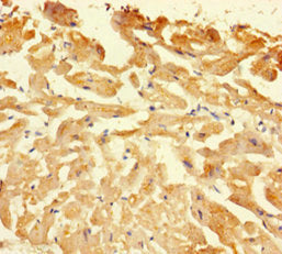 Immunohistochemistry of paraffin-embedded human heart tissue using CASP1 Antibody at dilution of 1:100