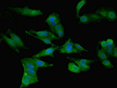 Immunofluorescent analysis of Hela cells using CCL2 Antibody at dilution of 1:100 and Alexa Fluor 488-congugated AffiniPure Goat Anti-Rabbit IgG(H+L)Rabbit anti-Human CCL2 Polyclonal Antibody