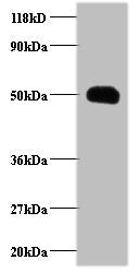 Western blot  | All lanes: CCL2 antibody at 2µg/ml + EC109 whole cell lysate  | Secondary  | Goat polyclonal to rabbit IgG at 1/15000 dilution  | Predicted band size: 12 kDa  | Observed band size: 50 kDa
