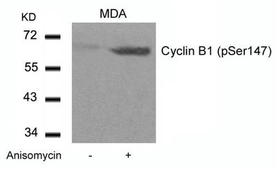 Western blot analysis of extracts from MDA cells untreated or treated with Anisomycin using Cyclin B1(phospho-Ser147) Antibody.