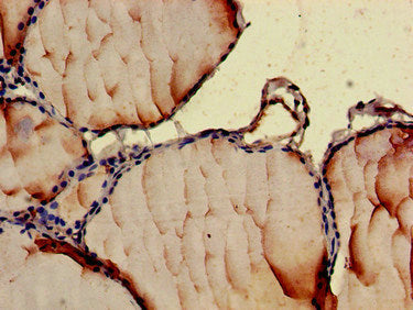 Immunohistochemistry of paraffin-embedded human thyroid tissue using CCL3 Antibody at dilution of 1:100Rabbit anti-Human CCL3 Polyclonal Antibody